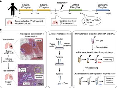 Integrated spatial analysis of gene mutation and gene expression for understanding tumor diversity in formalin-fixed paraffin-embedded lung adenocarcinoma